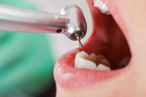 Best Walk-In Emergency Dentist in Fair Oaks, GA